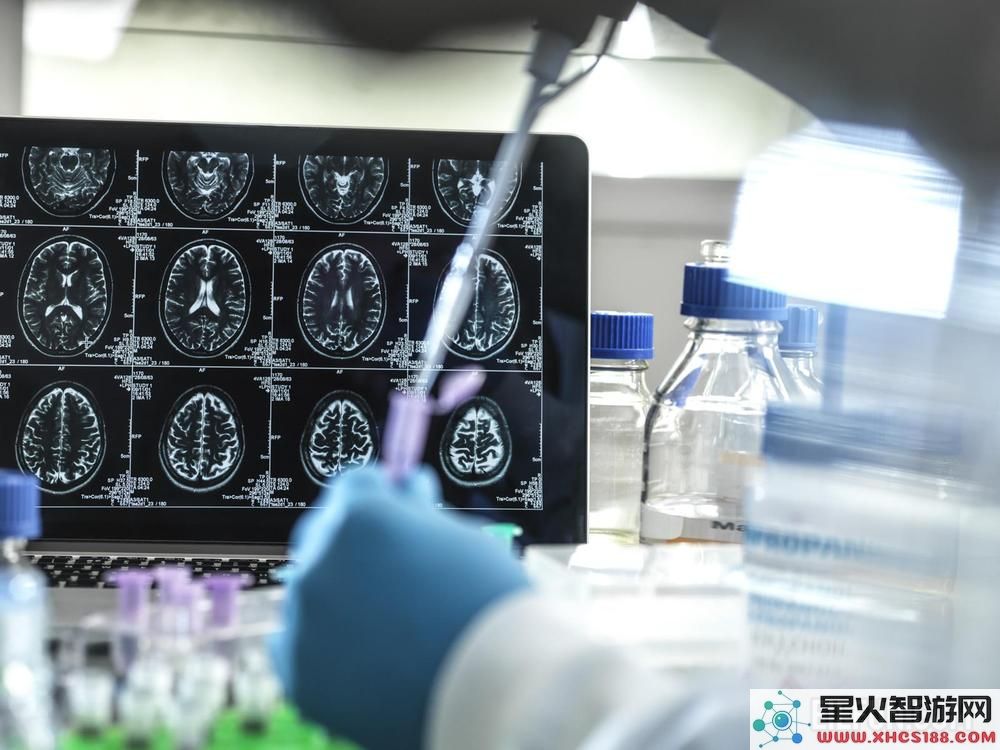科学家研发新技术能够通过血液检测阿尔茨海默症的早期迹象