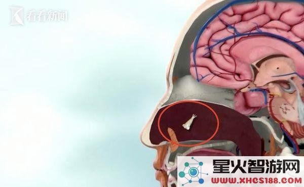 男子因用自来水洗脸感染致命“食脑虫”，死亡率惊人高达97％