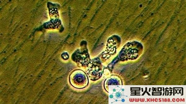 男子因用自来水洗脸感染致命“食脑虫”，死亡率惊人高达97％