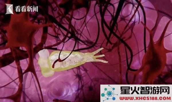男子因用自来水洗脸感染致命“食脑虫”，死亡率惊人高达97％