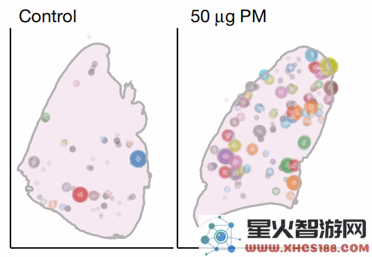 一年内肺癌导致180万人逝世科学家揭示预防肺癌的新关键